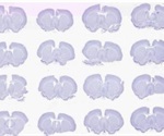 TissueScope™ - Huron Digital Pathology’s Rodent Brain Imaging Solution