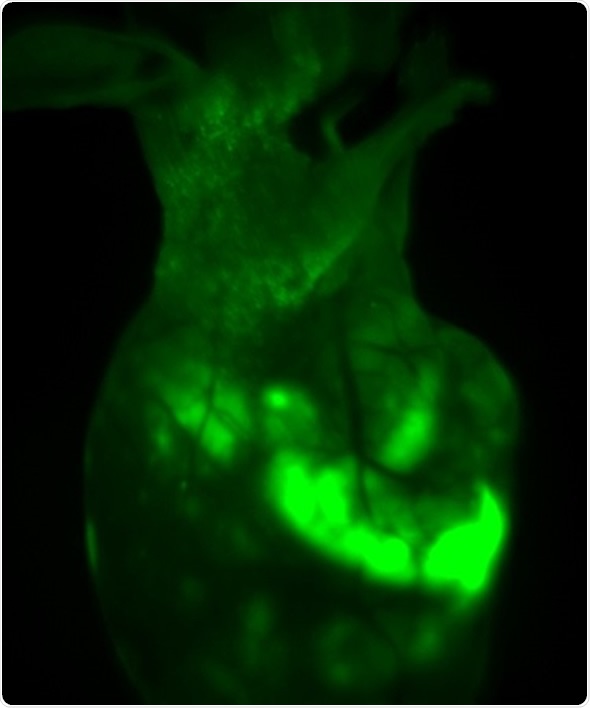 In vivo GFP fluorescent imaging of mouse transplanted with HepG2-GFP driven tumor. The image shows the mouse one month after orthotropic transplanted tumor in liver lobes, with survival and migration of transplanted tumor cells.