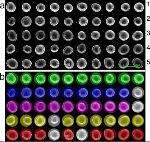 (a) Grayscale image mosaic of 50 unique serum biopsies (row 1 non-cancer controls, 2 brain, 3 breast, 4 lung, and 5 skin cancer patient samples). The scale bar displays 500 pixels (equivalent to a spatial resolution of 2.1 mm at a ? = 5.5 µm). (b) Classification outcomes for correct cancer diagnosis were accurate to 90%, 90%, 90%, and 80%, highlighted by color for brain (blue), breast (pink), lung (yellow) and skin (red) cancer samples respectively.
