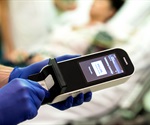 New handheld blood test to detect and evaluate concussions to be developed by Philips and Banyan Biomarkers