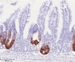 Mitochondria regulates stem cell proliferation in gut epithelium, study shows