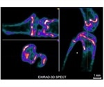 MILabs launches EXIRAD-3D quantitative autoradiography for fast imaging of tissue samples