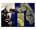 Mesolens microscope uses Prior Scientific's precision stages and focusing systems for 3D imaging of biomedical specimens