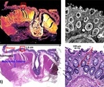 Using a Spero® Microscope for Large-Area Infrared Chemical Imaging of Colorectal Tissue