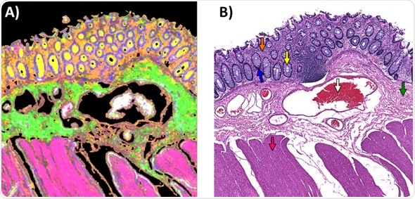 A) Random Forest Classification Imaging Result applied to an infrared image recorded from the unstained parallel tissue section shown in the Brightfield H&E image in B). The colored arrows indicate the 6 tissue classes as follows (white = blood, Green = Submucosa, Orange = Lamina Propria, Yellow = Goblet cells of Crypts, Blue = Colonocytes, Pink =Muscularis Externa. These colors match the spectrally stained color of the Random Forest classified Image in A).
