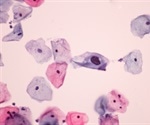 What is cytopathology?