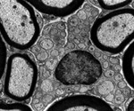 What is Transmission Electron Microscopy?