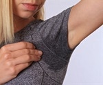 Uncontrollable sweating of hyperhidrosis can have serious impact on person