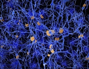 Researchers uncover new findings about the role of tau in neurodegenerative disease