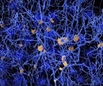 Imbalanced bacterial community in the gums linked to Alzheimer's disease biomarker