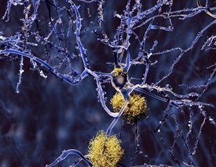 Scientists identify a possible “Achilles’ heel” in the frustration of amyloid beta peptides