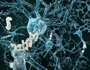 Study uncovers mechanisms underlying microglia-driven neuroinflammation in Alzheimer's disease