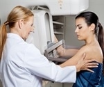 New X-ray phase-contrast mammography for breast investigations