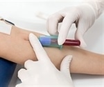 Simple fingerprick blood test could help identify millions of people with undiagnosed diabetes