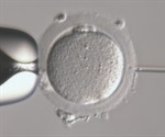 Intracytoplasmic Sperm Injection Using Eppendorf Transferman® 4m Micromanipulator