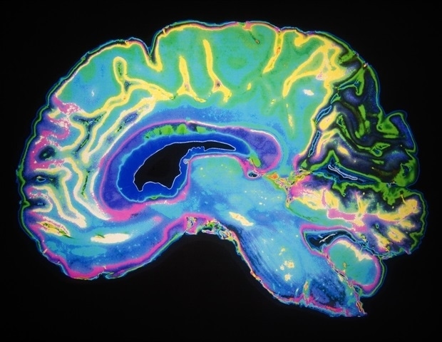 Proper nutrition could boost recovery from traumatic brain injury
