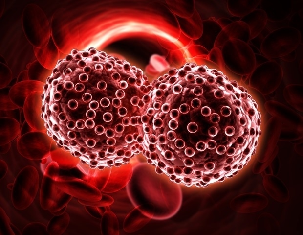 Examine reveals how irritation alters the tumor microenvironment in acute myeloid leukemia