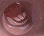 Research reveals a novel key player in the initiation of colon cancer