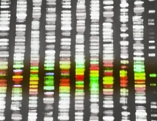 Chromosomal microarray analysis could help identify the cause of SIDS or SUDC in older children