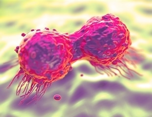 New study pinpoints mitochondria as key player in dietary fat-cancer connection