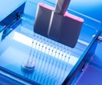 What Does Gel Electrophoresis Involve?