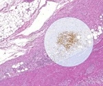 microDimensions releases upgraded version of free digital pathology viewer Zoom