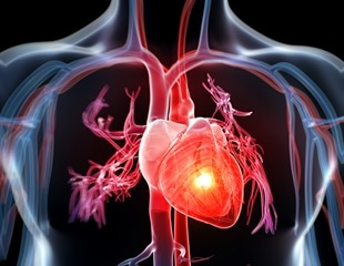 Aspirin underutilized for preventing heart attack, stroke
