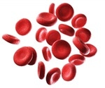 Pregnant women with anemia more likely to need blood transfusions after cesarean delivery