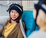 Scalp cooling provides safe, effective treatment in prevention of chemotherapy-induced alopecia