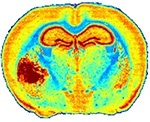 A mouse brain tissue section analysis by IR microscopy showing the anatomical details of brain with tumor (left part) based on extracellular matrix distribution. FTIR acquisition lasted 12h for a 20-µm resolution while QCL-IR acquisition could be done in 1h50 with a 4.4-µm resolution.