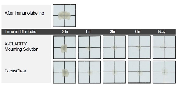 Comparison of cleared mouse brain slices incubated in the X-CLARITY™ Mounting Solution and the FocusClear.