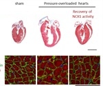 NCX1 protein could help prevent progression of heart failure