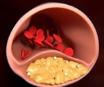 New effective method of treatment against increased cholesterol