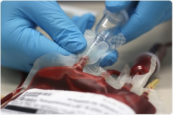 A bag of transfusion blood - Image Copyright: SebGross / Shutterstock