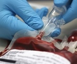 HIV and Blood Transfusions