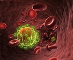 When Does HIV Become AIDS?