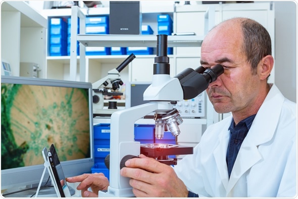 Scientist examines biopsy samples. Image Copyright: science photo / Shutterstock