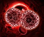 Blood cancer is associated with considerably higher healthcare costs than other cancers