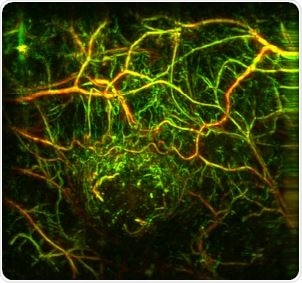 Imaging of tumor vasculature in a mouse model acquired with raster scan optoacoustic mesoscopy (RSOM).
