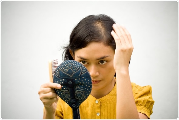 Share more than 108 ludwig pattern hair loss latest