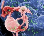 New project clarifies molecular processes involved in hidden HIV reservoir