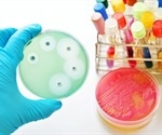 The UN General Assembly call for global action to tackle antimicrobial resistance