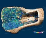 Micro-CT in Preclinical Imaging: Bone Regeneration in Three Dimensions