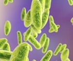 NIAID awards $4.4M grant to study unknown gene function in bacteria that cause plague, brucellosis