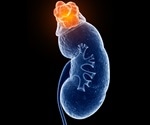 Prolonged use of popular heartburn drugs linked to silent, gradual kidney damage