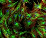 3D cell culture system tests how inhibiting fibroblast activities can help treat lung cancer