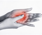 Concomitant diabetes associated with osteoarthritic hand pain