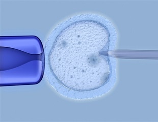 Understanding public perception of polygenic embryo screening for IVF