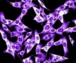 Melanoma cells create own 'green light' signal to spread in the body