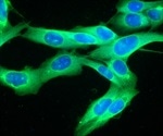 Inhibiting a key metabolic enzyme selectively kills melanoma cells and stops tumor growth